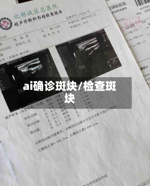 ai确诊斑块/检查斑块