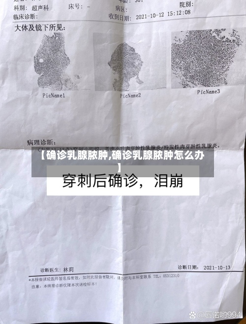 【确诊乳腺脓肿,确诊乳腺脓肿怎么办】