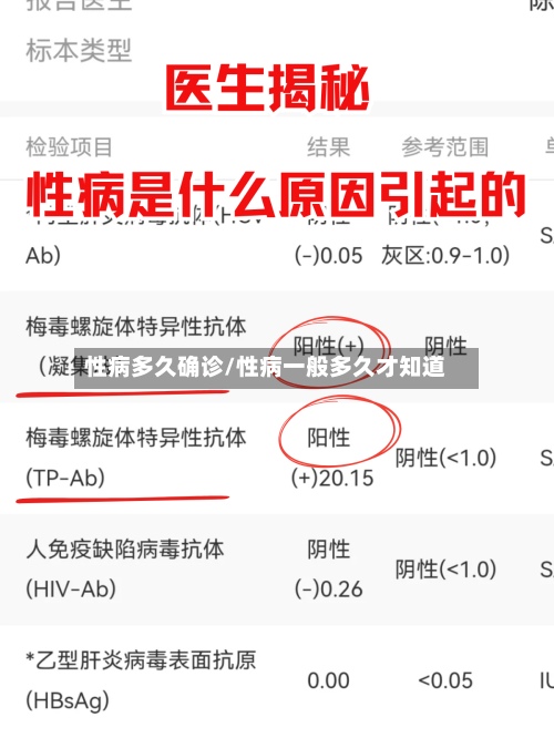 性病多久确诊/性病一般多久才知道