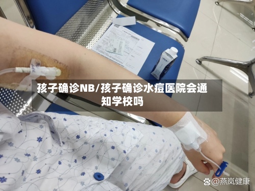 孩子确诊NB/孩子确诊水痘医院会通知学校吗