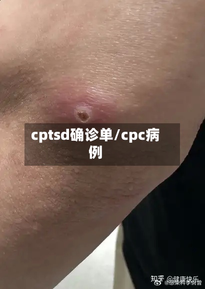 cptsd确诊单/cpc病例-第3张图片