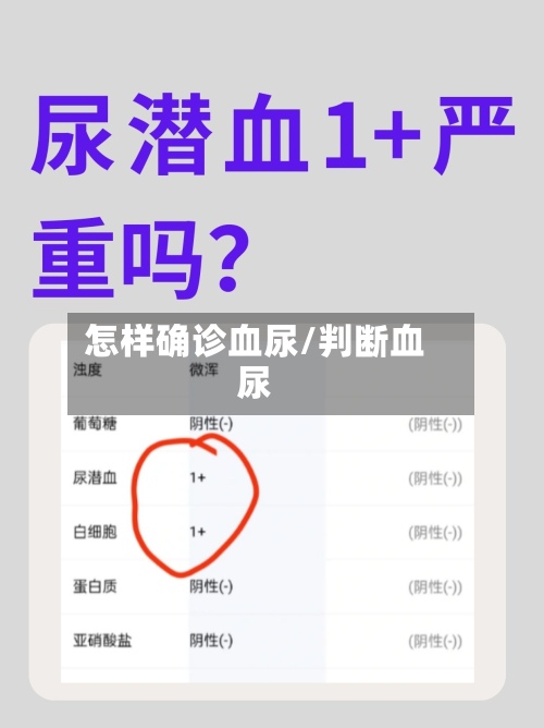怎样确诊血尿/判断血尿