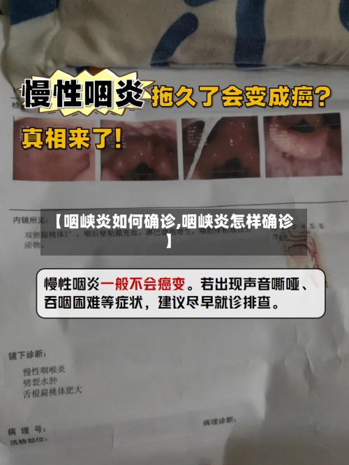 【咽峡炎如何确诊,咽峡炎怎样确诊】
