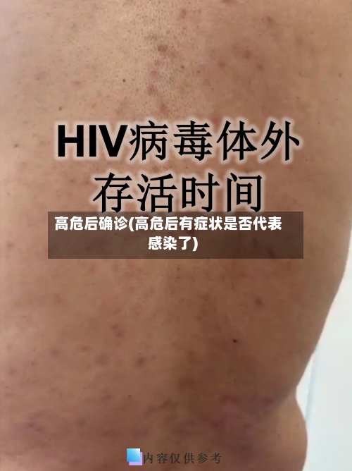 高危后确诊(高危后有症状是否代表感染了)-第3张图片