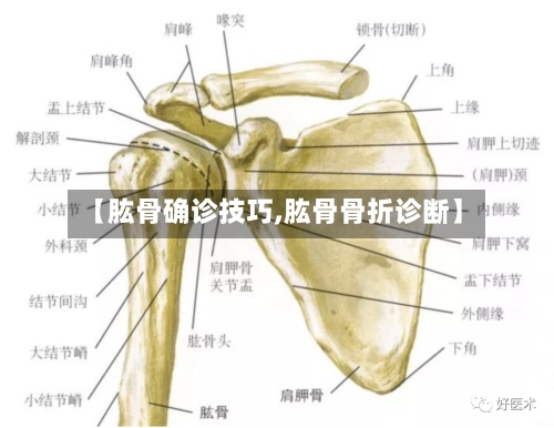 【肱骨确诊技巧,肱骨骨折诊断】