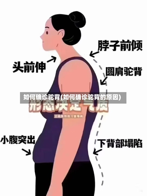 如何确诊驼背(如何确诊驼背的原因)
